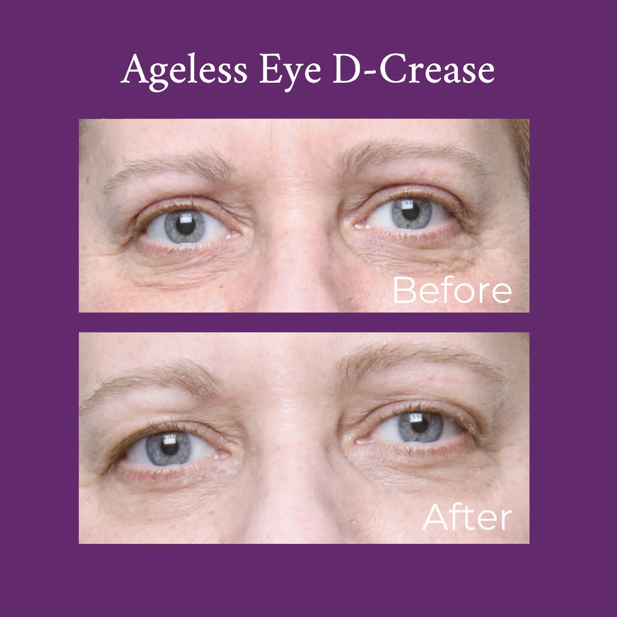 Ageless Eye D-Crease - Image 3