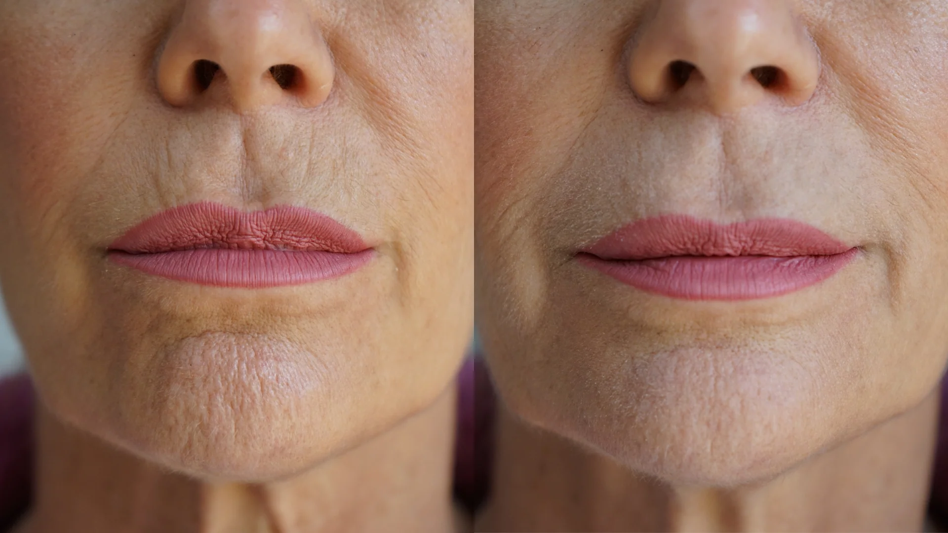 Ageless Lip & Line Filler - Image 6