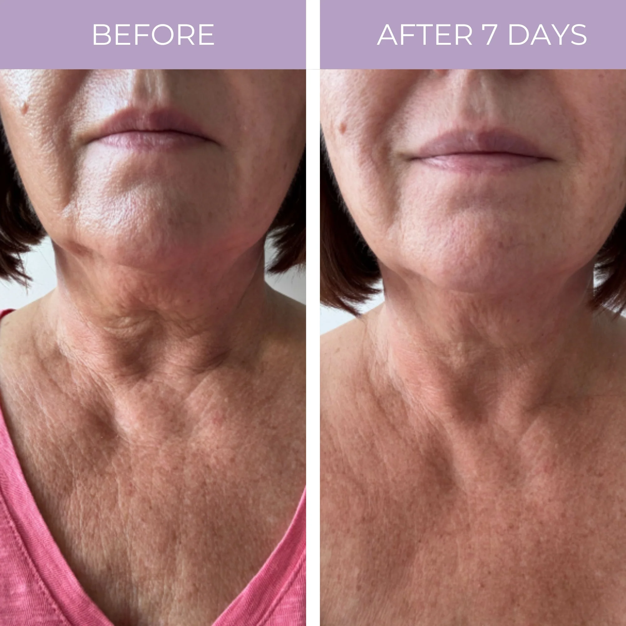 Ageless Throat & Decolletage Anti-Aging Neck Creme - Image 4