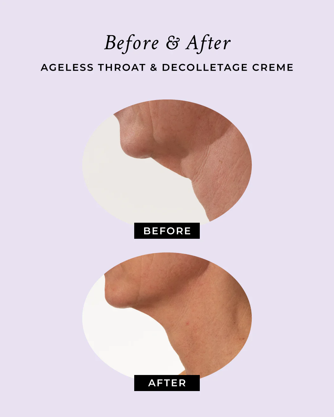 Ageless Throat & Decolletage Anti-Aging Neck Creme - Image 5